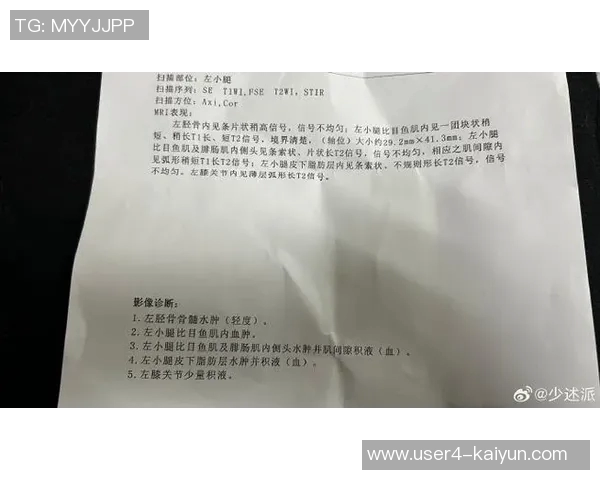 卡梅隆托马斯腿筋拉伤本周末将接受MRI检查后续情况将及时更新